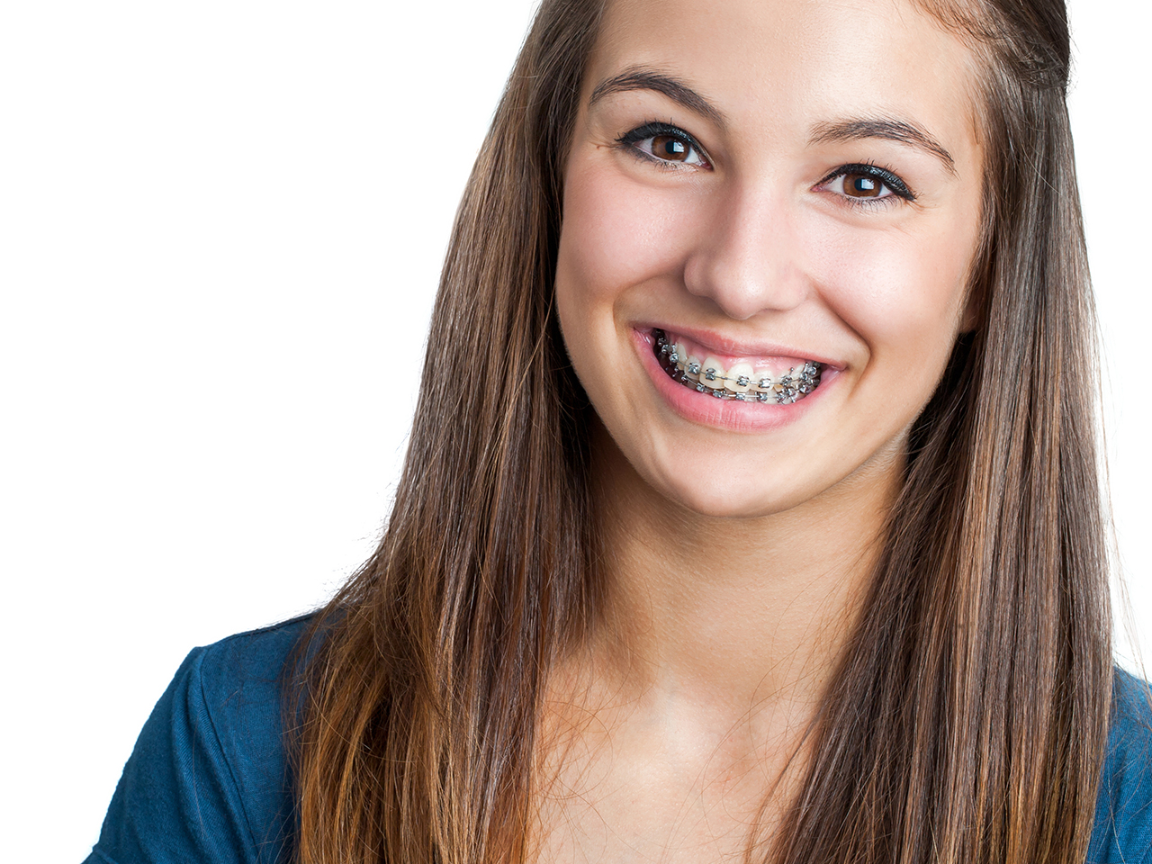 What to Know Before Starting Orthodontic Treatment